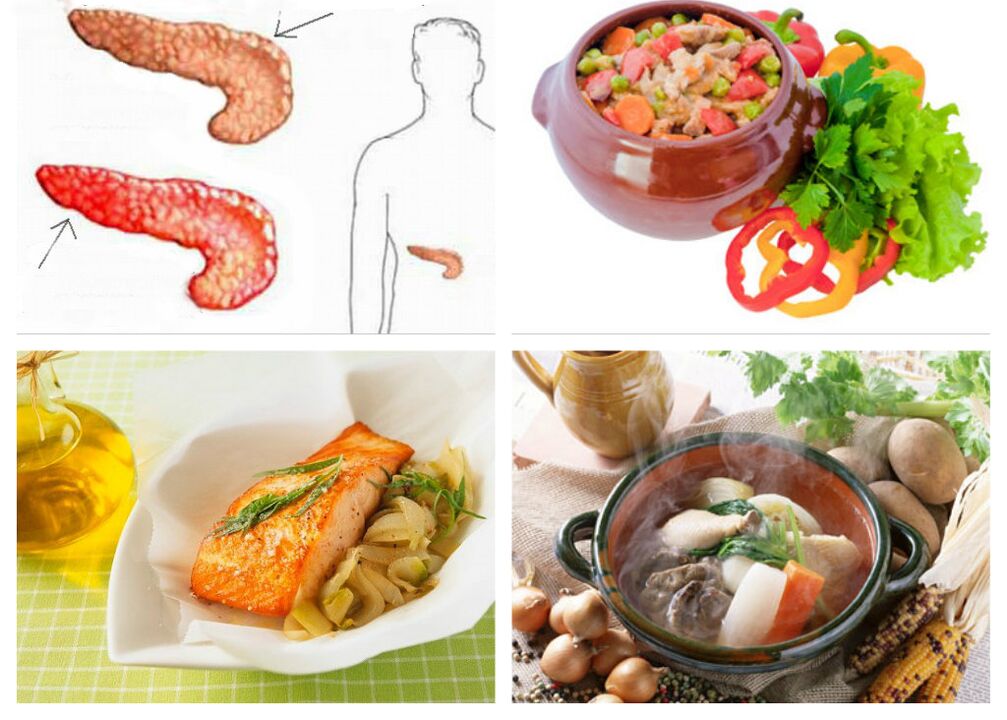 Dieta pentru pancreatită